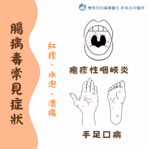 腸病毒常見症狀