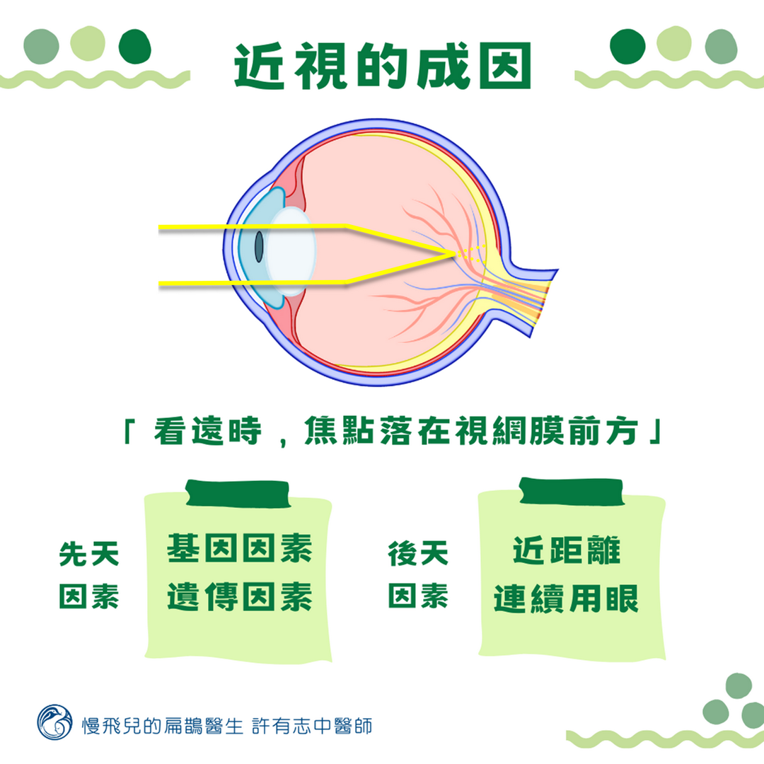 近視的成因