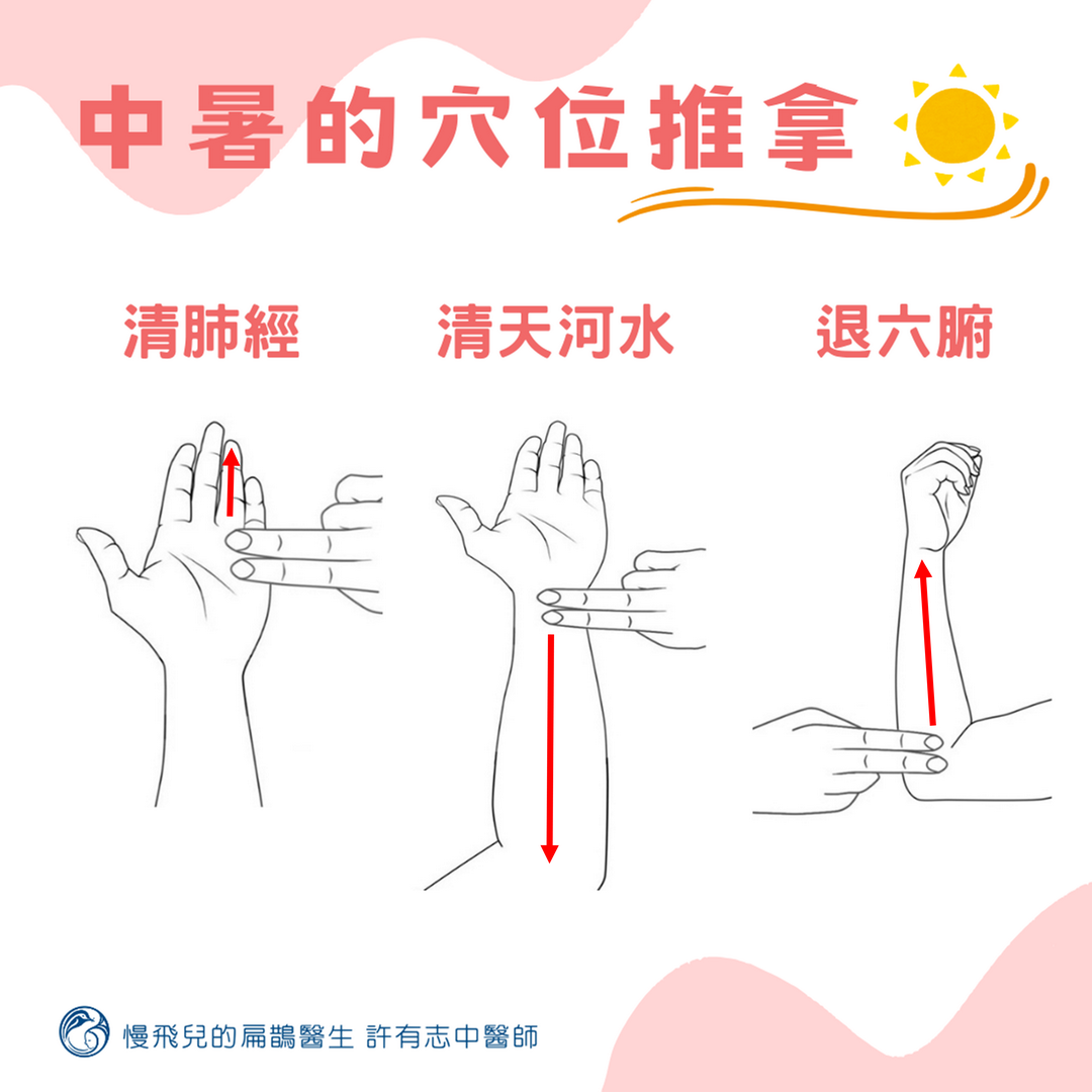 中暑的穴位推拿