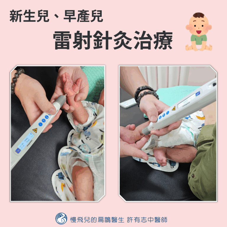 新生兒早產兒雷射針灸治療
