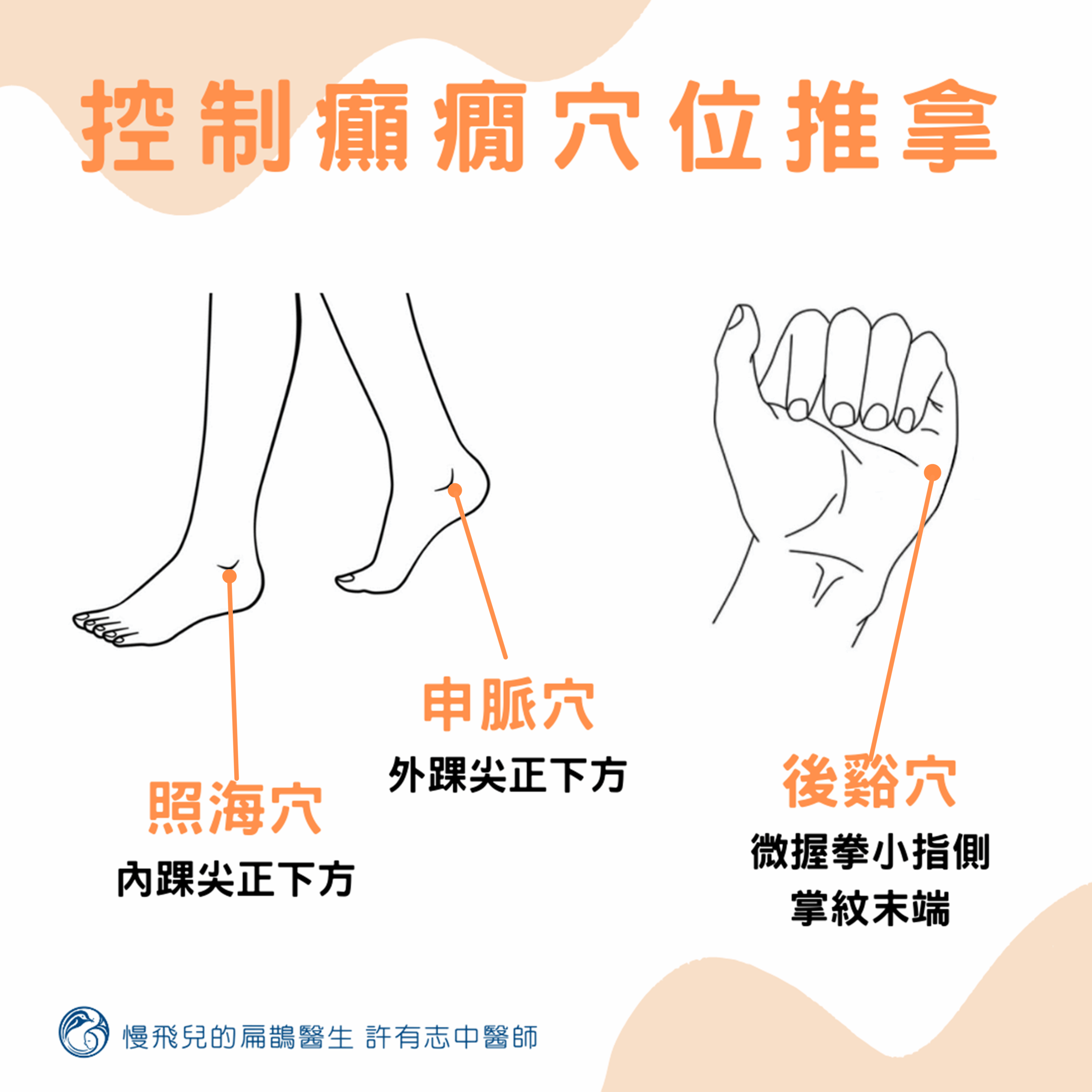 控制癲癇穴位推拿